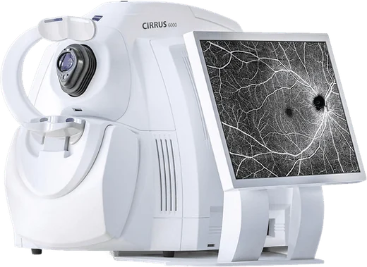 CIRRUS 6000 검사 장비(모니터 달린 OCT)